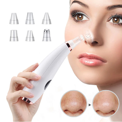 Blackhead Remover Vacuum  Electric Pore Cleaner, Acne & Black Spot Removal Facial Tool