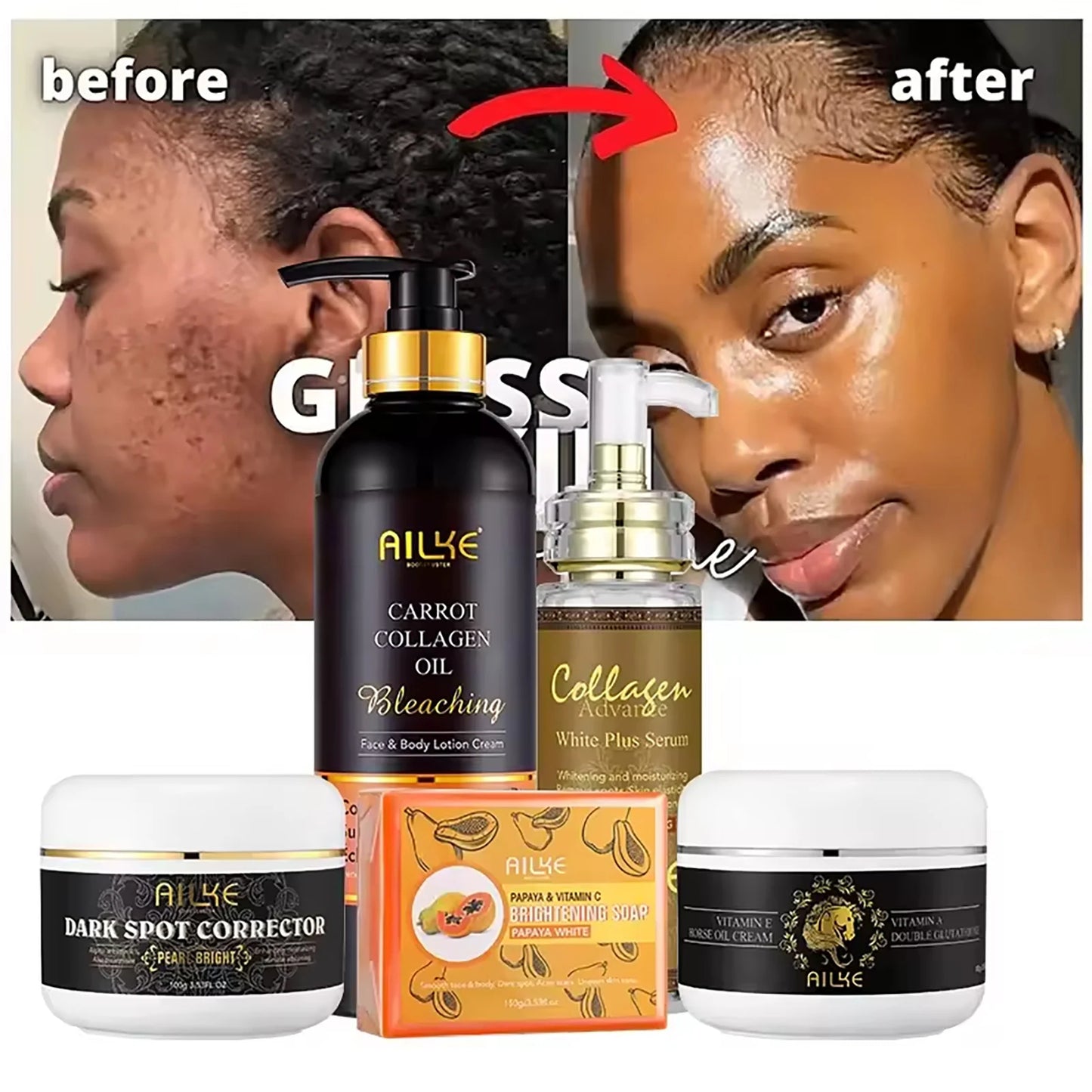 AILKE Collagen 5 in 1 Skin Care Set  Moisturizing, Whitening, Anti Aging & Freckle Removal Face Kit for Glowing Skin