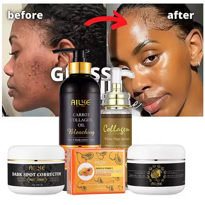 AILKE Collagen 5 in 1 Skin Care Set  Moisturizing, Whitening, Anti Aging & Freckle Removal Face Kit for Glowing Skin