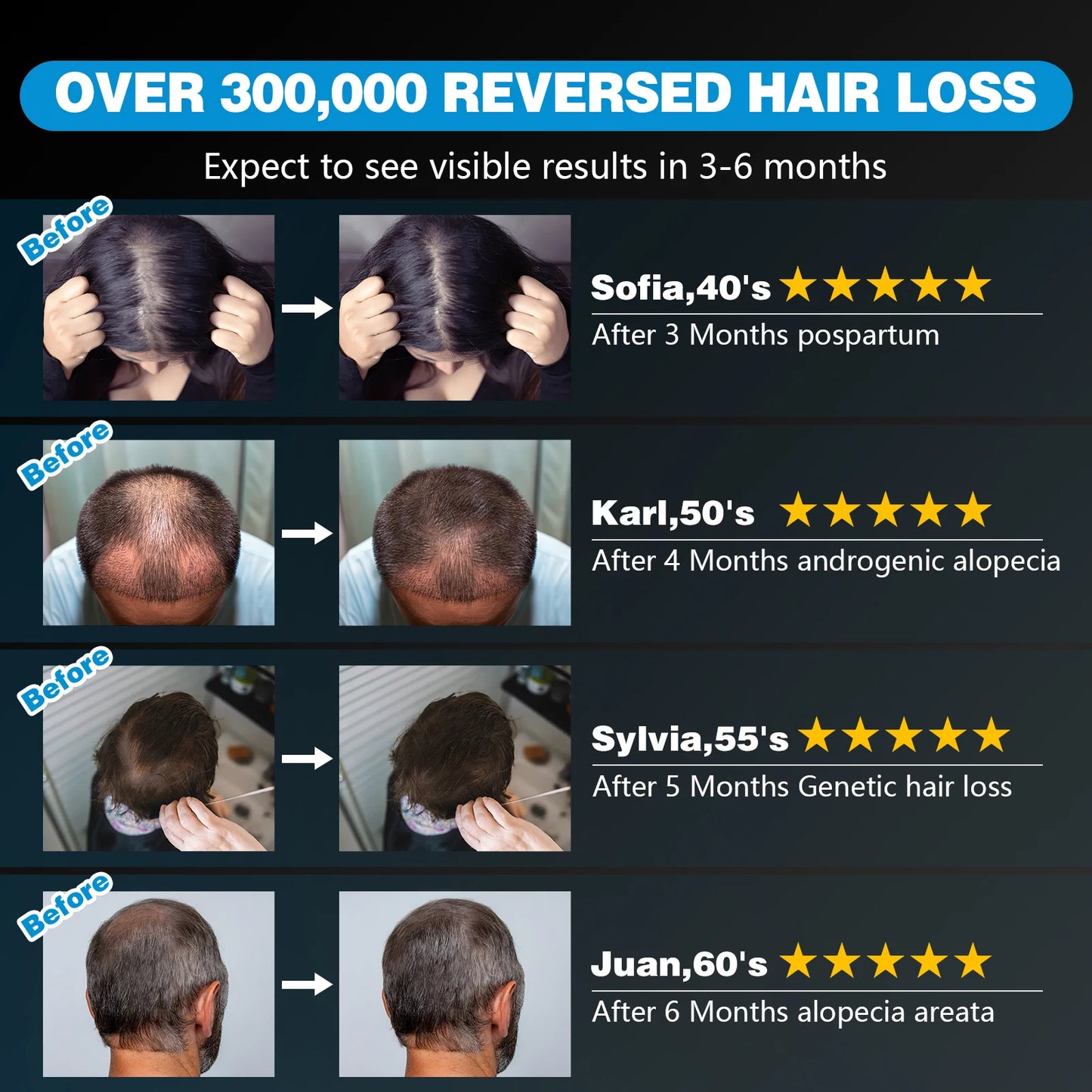 120 Diodes Hair Growth Cap  Red Light Therapy (660nm & 850nm) for Hair Regrowth, Anti Hair Loss & Scalp Relaxation